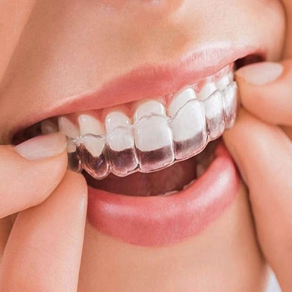 Niềng răng Invisalign